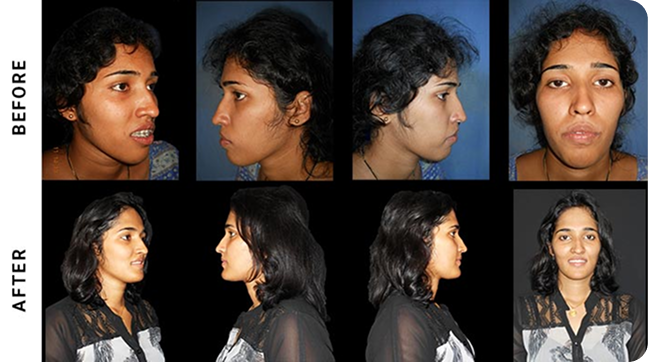 Before Surgery